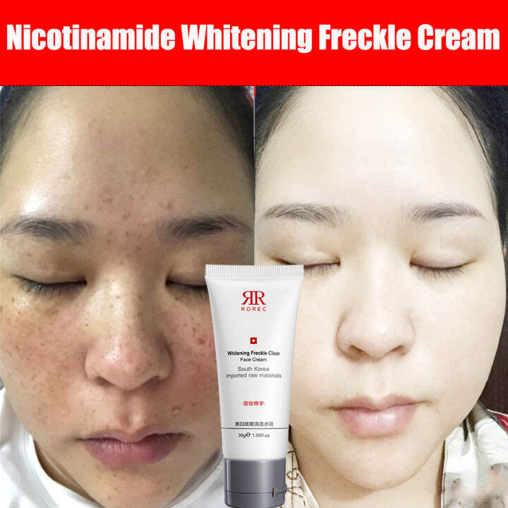 Nicotinamide Whitening Freckle Clear Face Cream 30g Lazada PH