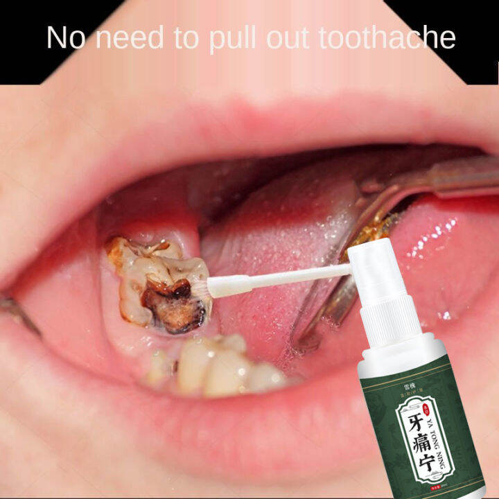 Quick Toothache Relief Spray 30ml Eliminate swollen gums, bleeding gums