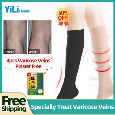 Varicose Veins Socks Vasculitis Phlebittis Spider Legs Treatment Vein Stretch Compression Medical Stockings 1 Pair Leg Care