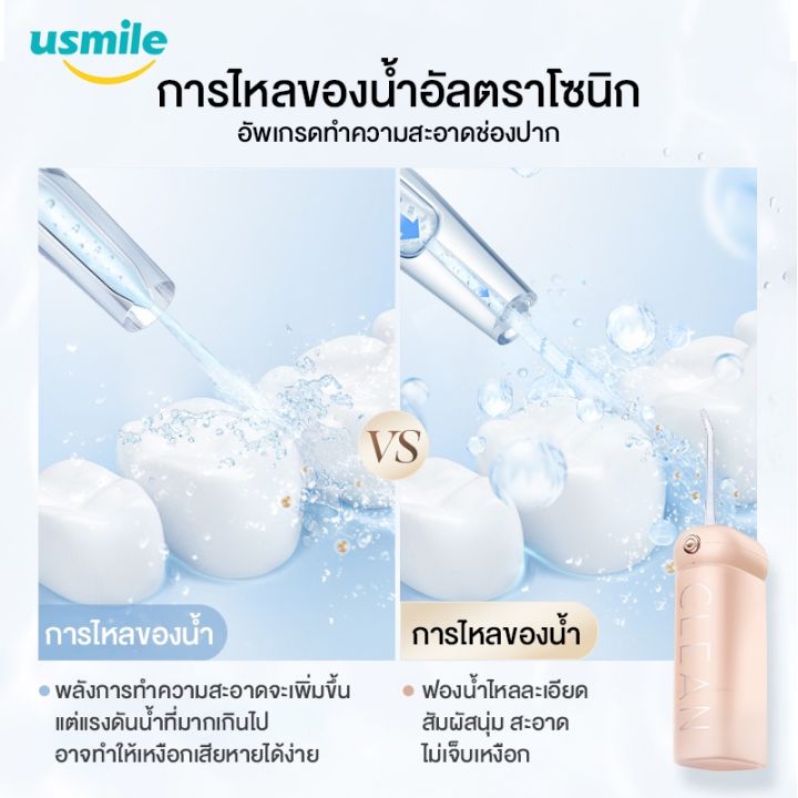 usmile-cy1-soft-care-ultrasonic-water-flosser-เครื่องฉีดฟัน-เครื่องขัดฟันพลังน้ำ-ไหมขัดฟัน-น้ำ-ไหมขัดฟันพลังน้ำ-เครื่องทำความสะอาดฟัน-เครื่องขัดฟัน-เครื่องพ่นน้ำทำความสะอาดฟัน