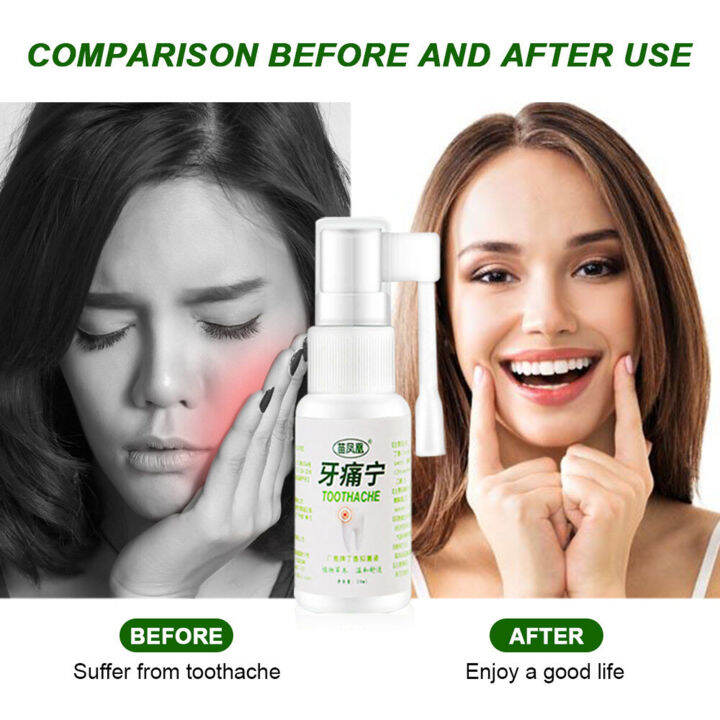 20ML Toothache Pain Relief Spray Prevent Tooth Cavities Quick Pain ...