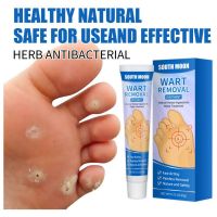 【CW】 Foot Care Medical Corn Removal Pads Warts Thorn Curative Cream Calluses Callosity Wart Ointment Treatment Against Moles Skin