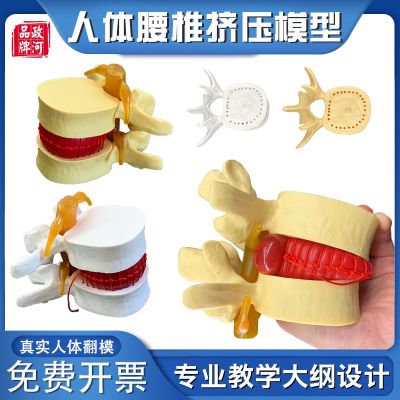 Zheng river extrusion model of lumbar prominent vertebral spine human body bone bonesetting massage medical demonstration teaching