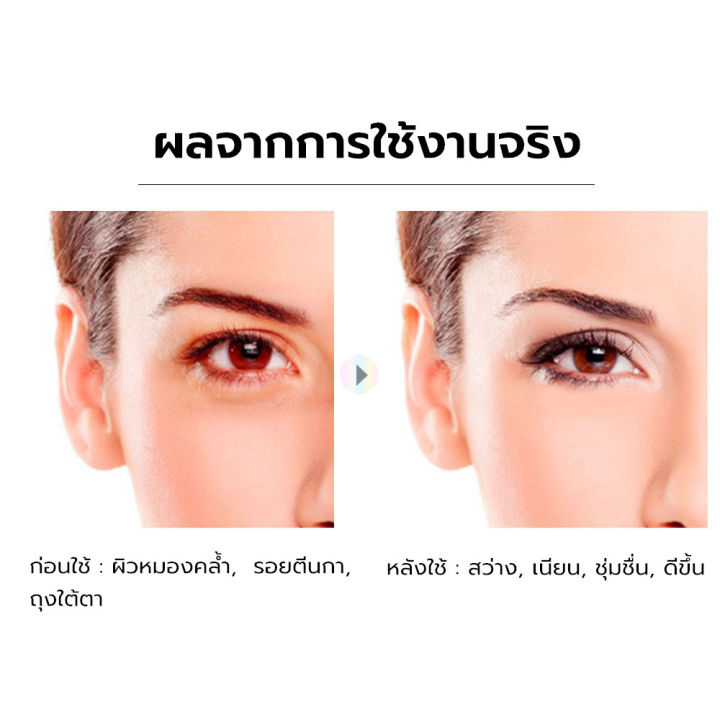 breylee-แผ่นแปะใต้ตา-มาร์คใต้ตา-บำรุงผิวดูแลริ้วรอย-ความหมองคล้ำบริเวณรอบดวงตา-ดูแลถุงใต้ตา-ริ้วรอย-บำรุงผิวรอบดวงตา-1คู่