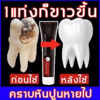 Q.LI/NASSMEI ยาสีฟันขจัดปูน สีฟันขจัดหินปูน ดูแลฟัน ขจัดคราบฟันปากแข็ง