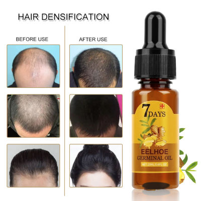 ZWM【HOT Doll7 DAYS Effective Natural Ginger Plant Serum Hair Loss Repair Hair Loss Product Series Hair Growth Products