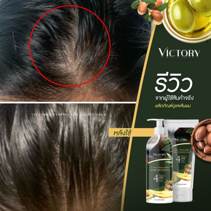 ชื้อ1ฟรี-1-เซรั่ม-วิคตอรี่-victory-hair-shampoo-เซรั่มป้องกันผมขาดหลุดร่วง-ผมแห้งเสีย-ผมแตกปลาย-1-แถม-1