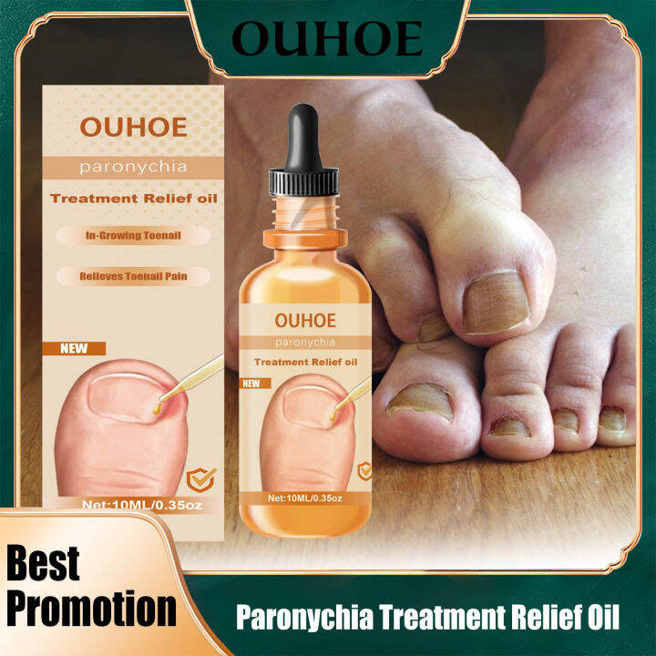 Ouhoe Paronychia Treatment Relief Oil Soften Ingrown Nail Remove