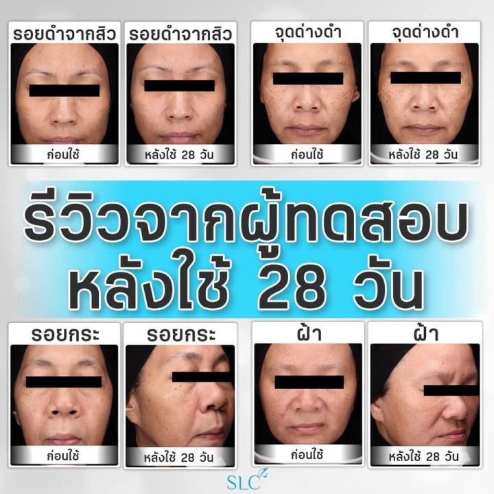 เซรั่มลดริ้วรอย-เซรั่มลดฝ้ากระ-เซรั่มลดรอยดำ-เซรั่มลดรอยย่น-ยกกระชับผิว-slc-serum-slc-7-peptide-แบรนด์-slc-ส่งฟรี-ไม่เห็นผลยินดีคืนเงิน