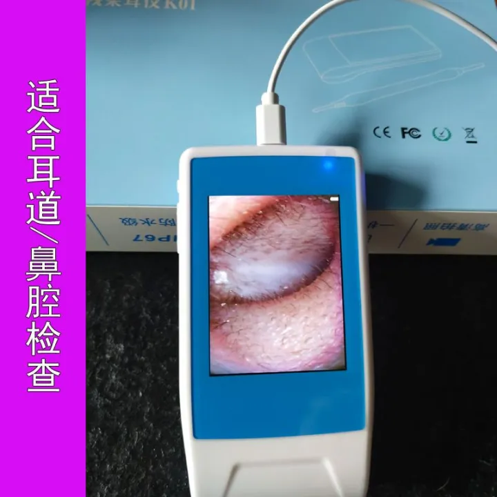 720P HD Visual Endoscope Ear Cleaning Endoscope Dig Ear Cleaner Ear