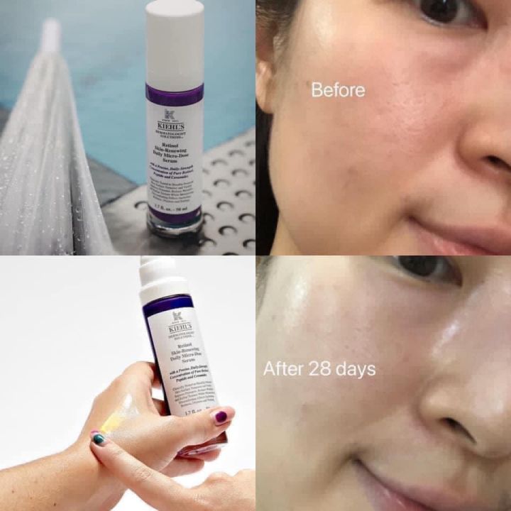 ผลิตภัณฑ์ดูแลผิวที่มีตราสินค้า-retinol-skin-renewing-daily-micro-dose-serum-50ml-เรตินอลรีไวทัลไลซิ่งเดลี่ไมโครโดสเซรั่ม-50มล