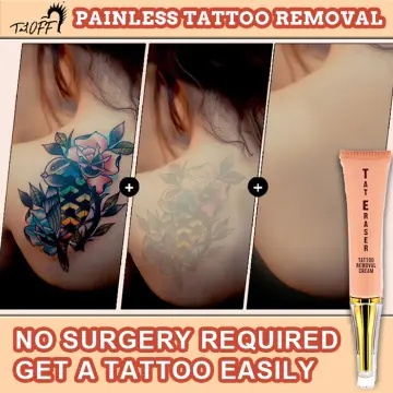 Permanent Tattoo Removal CREAM Johannesburg  Tattoo Removal  Beauty4Me