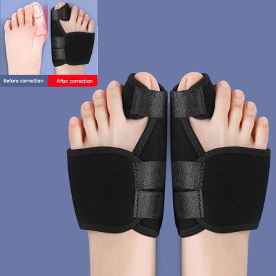 【Chasers กลางแจ้ง Store】เท้าแก้ไขหัวแม่มือเบี้ยวเข็มขัดที่รองปุ่มหัวแม่เท้าที่คั่นนิ้วเท้าการแก้ไขข้อต่อดูแลเท้าเท้า Orthotics นิ้วเท้านุ่มแขน