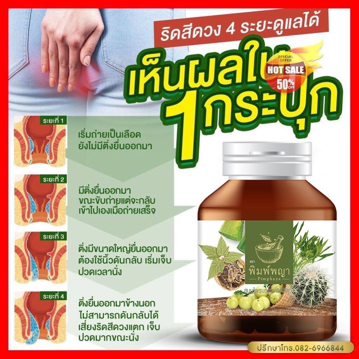 ซื้อ-1แถม1-ริชชี่พิมพ์พญา-ริดสีดวงทวารชายและหญิง-ริดสีดวงทวารภายในและภายนอก-ส่งฟรี-เพชรสังฆาต-390บาท-ส่งฟรี