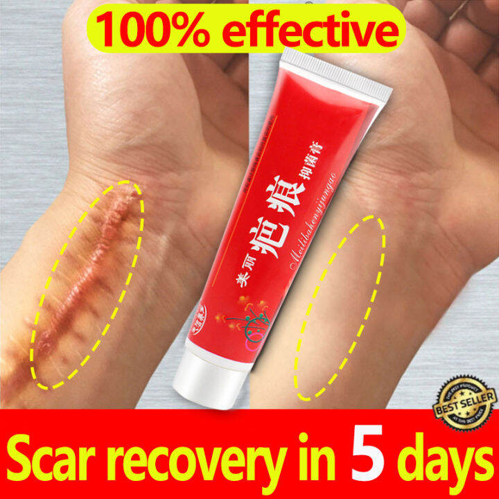 Scar Remover for Old Scar on Leg Scar Gel Original Stretch Mark Remover