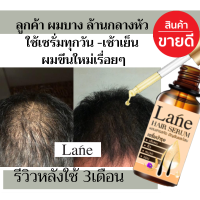 Lane ผมบาง หัวล้าน ผมร่วง เซรั่มปลูกผม ยาปลูกผม น้ำยาปลูกผม 14 วันหยุดร่วง 30วันผมขึ้นใหม่ ดกดำไม่หงอก