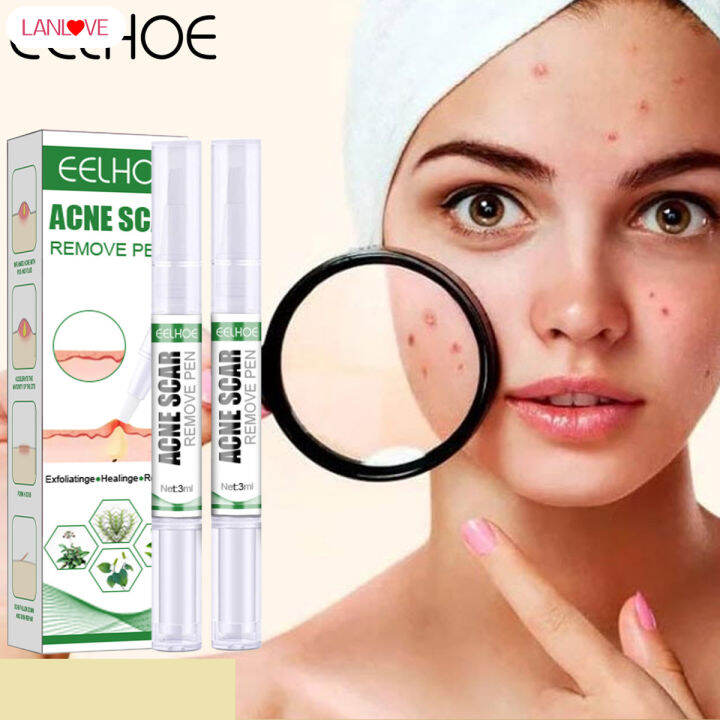 LANLOVE Acne Scar Removal Cream Repair Acne Pits & Reduce Acne Marks ...