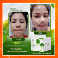 เซรั่มใบบัวบก พรทิน่า ว่านหางจระเข้เข้มข้น บำรุงล้ำลึก เน้นฟื้นฟูผิวหน้าที่แพ้สารและมลภาวะ ขนาด30 กรัมเซรั่มใบบัวบก ตัวดังในTik Tok