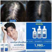 ลืมได้เลยว่าเคยผมร่วง!!! ซื้อ 1 แถม 2 ชุดปลูกผม LYO Hair Tonic ไลโอ หนุ่ม กรรชัย ของแท้ 100% เคลียร์ปัญหาร่วง บาง ล้าน หงอก ลดผมร่วง สร้างผมใหม่