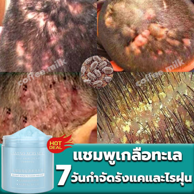 7 วันปรับสภาพเส้นผมให้ดีขึ้น แชมพูขจัดรังแค 250กรัม ยาสระผมรังแคขจัดรังแคและอาการคัน ยาสระผมเชื้อรา ยาสระผมแก้เชื้อรา ยารักษารังแค แชมพู เกลือทะเล แชมพูแก้เชื้อรา ยาสระผมแก้เชื้อรา แชมพูรักษารังแค ยาสระผมขจัดรังแค แชมพูสําหรับผมมัน shampoo