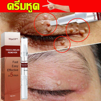 พร้อมส่ง ยาแต้มหูด ลอกหูดตาปลา ขจัดติ่งเนื้อ หูดข้าวสุก ที่จี้ไฝ ไม่ทิ้งร่องรอยปลอดภัยไม่เจ็บตัว Wart Removal Mole Remedy Liquid Pen