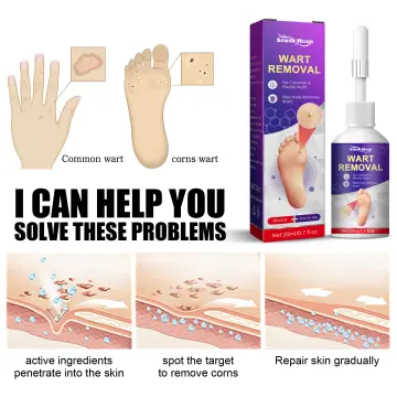 Dr. Scholl's Liquid Corn And Callus Remover - 0.33oz : Target