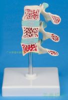 Spinal bone height loose model typical model the human body vertebra bone height loose tooling/lesions