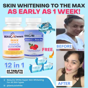 Buy Beauxi White Glutathione online Lazada .ph