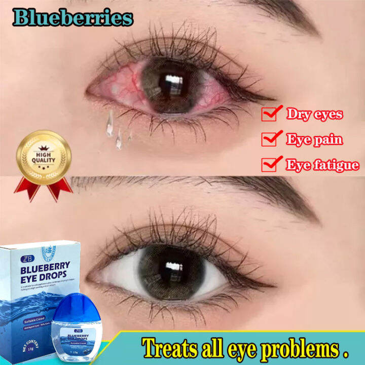Blueberries Eye drops original Eyedrops eye drops for clear vision