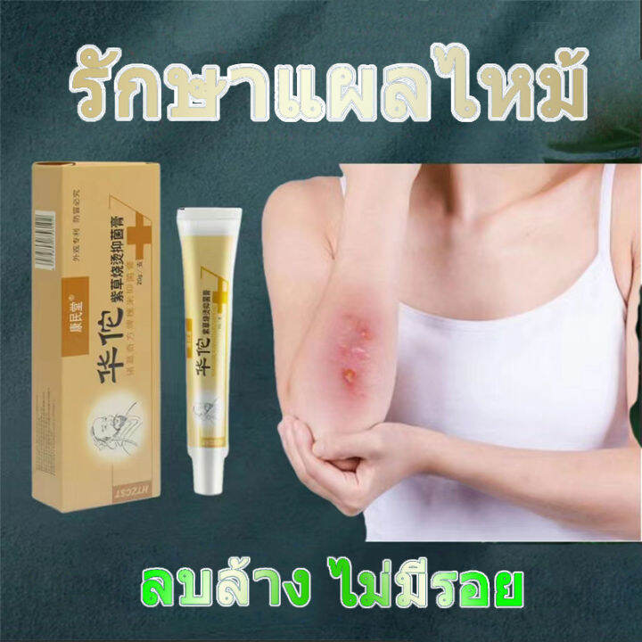 ครีมทารอยแผลเป็น กำจัดรอยแตกลาย แผลไฟไหม้ น้ำร้อนลวก ซ่อมแซมผิวที่เสียหาย บำรุงผิวให้แข็งแรง