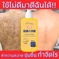 【HOT】ครีมอาบน้ำหอมๆ เจลอาบน้ำ กำจัดไร ขจัดเจลอาบน้ำไรฝุ่น ขจัดไรและสิวสบู่ สบู่เหลว เจลอาบน้ำ ครีมอาบน้ำ สบู่อาบน้ำ โฟมเยอะ อ่อนโยนไม่ระคายเคือง ยับยั้งไร ป้องกันผิวแห้งกร้าน รูขุมขนเล็กลง วบคุมความมัน สบู่กันไรฝุ่น ครีมอาบน้ำหอมๆ shower gel