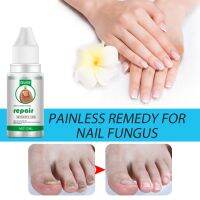 Eelhoe Onychomycosis Repair Liquid Nail Treatment Liquid Thicken Soft Nails TALLER