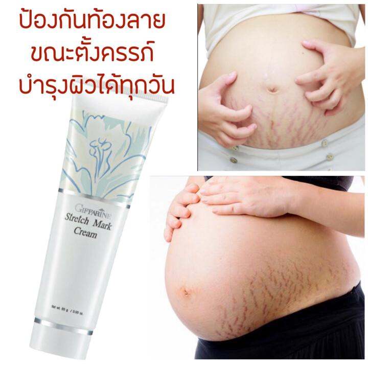 ครีมทาท้องลาย-ครีมท้องแตกลาย-ครีมแก้-ขาลาย-ครีมทาขาลาย-ครีมทาแขนลาย-สะโพกลาย-พร้อมกระชับผิว-ด้วยสารสกัดคอลลาเจน-และว่านหางจระเข้-กิฟฟารีน-giffarine-stretch-mark-cream