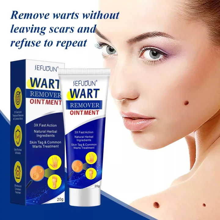 Wart Removal Cream Ubat buang kutil ketuat tahi lalat biji kolestrol ...