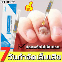 【ของแท้100%】EELHOE เซรั่มซ่อมแซมเล็บ เซรั่มรักษาเล็บ บำรุงเล็บให้สวย ซ่อมแซมเล็บเสีย กำจัดเล็บเสีย ส่งเสริมการเจริญเติบโตของเล็บดีเยี่ยม ไม่ทำร้ายเล็บดี ห่างกับปัญหาเล็บ（ยารักษาเชื้อราที่เล็บ ครีมบำรุงเล็บ ยาแก้เชื้อราที่เล็บ เซรั่มเล็บขบ เชื้อราเล็บมือ）