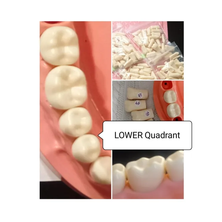 LOWER Quadrant Dental Typodont Replacement Teeth (Mandibular Nissin