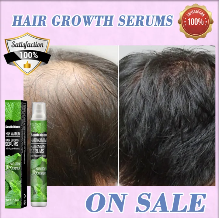 Great Price】100% Effective Hair Grower For Men Original Peppermint Extract  Hair Growth Oil Hair