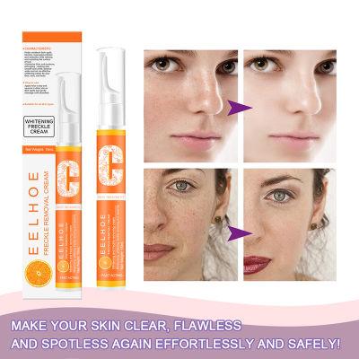 BeautyIU【Ready Stock】【Anti-freckle】Instant Blemish Removal Gel VC Whitening Freckle Cream Pen Brighten Whiten Skin Remove Freckle Pigmented Melanin Spots (พร้อมสต็อก)