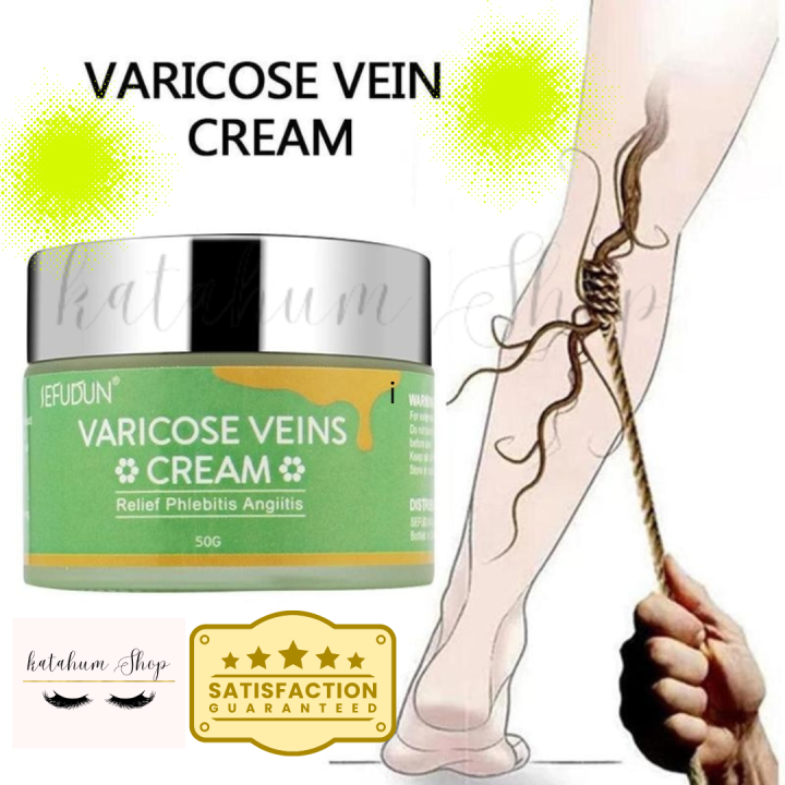 Varicose Veins Cream 50g Varicose Vein Soothing Leg Cream Natural Varicose And Spider Veins