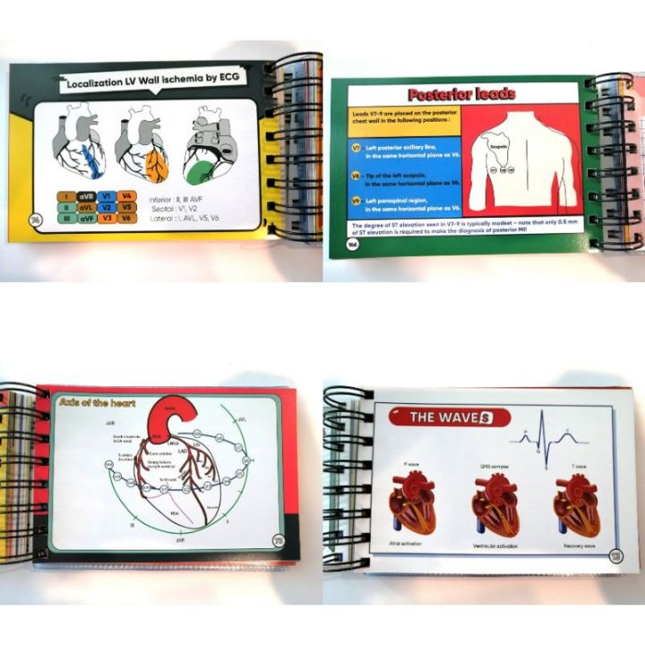 ขายดี-หนังสือ-a-beginners-plearn-with-ekg-electrocardiography-ezy-card-the-review-book-of-practical-ecg-ตำราแพทย์-บริการเก็บเงินปลายทาง