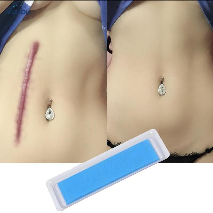 Vuubu 【100 Authentic】Removal Cesarean Section Hypertrophic Keloid Skin Scars Therapy Treatment