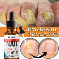 10/20/30Ml Ginger Foot Removal Athletes Foot Repair Treatment Liquid Antifungal Essence Healthy Nail Care Repair Liquid