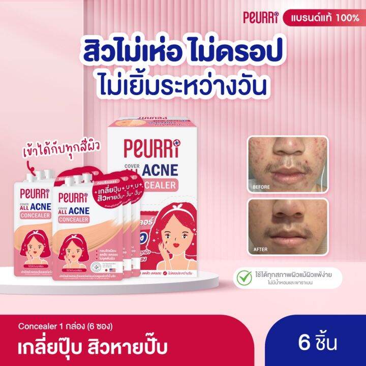 แพ็ค-6-ชิ้น-peurri-cover-all-acne-concealer-คอนซีลเลอร์ปกปิดสิว-รอยสิว-3g