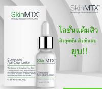 SkinMTX Comedone Acti-Clear Lotion.สำหรับคนที่ผิวมัน-ผิวผสม มีปัญหาสิว สิวอุดตัน สิวเสี้ยน สิวอักเสบ รูขุมขนกว้าง