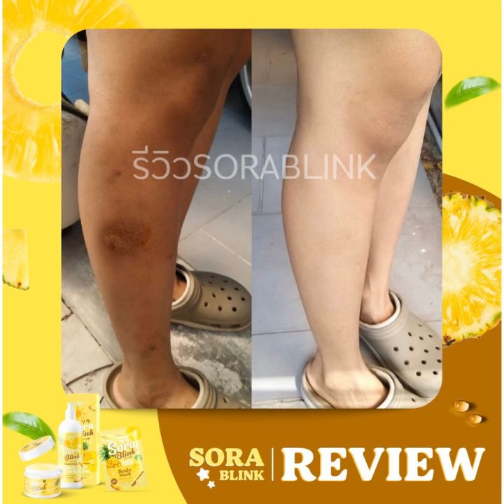 พร้อมส่ง-ส่งฟรี-sora-blink-ชุดครีมสับปะรด