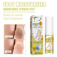 【CW】 30ml Foot Peeling Spray Natural Orange Essence Pedicure Hands Dead Skin Exfoliator Mask Whiten Baby Care Tool Cosmetics