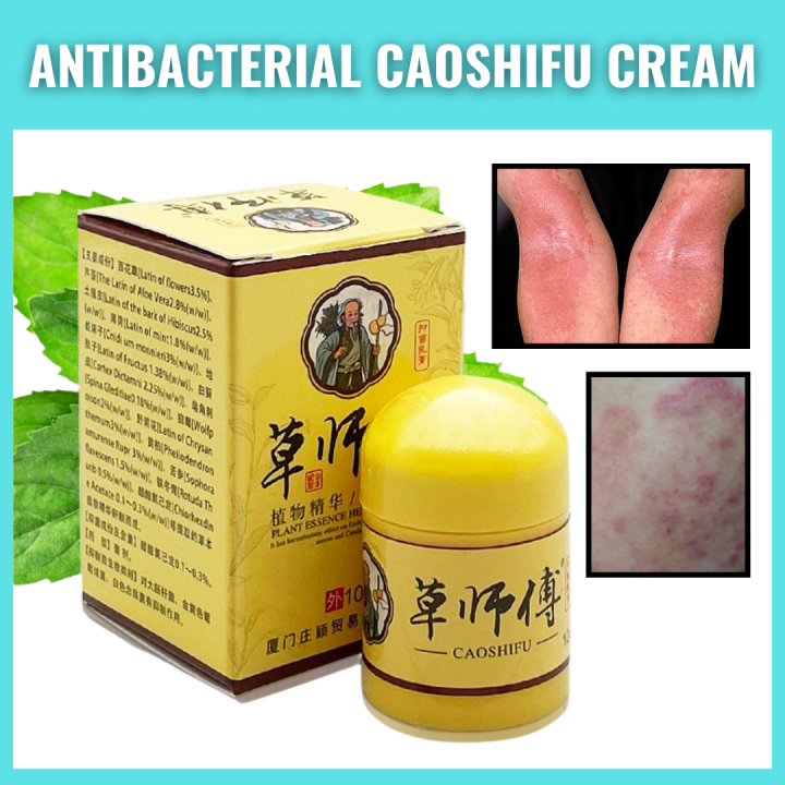 New Sale Caoshifu Cream Psoriasis Eczma Cream Natural Chinese Caoshifu Herbal Medicine Cream 9473