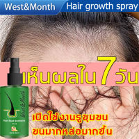 ของแท้100%！West&amp;Month น้ำยาปลูกผม สเปรย์ป้องกันศีรษะล้าน ยาปลูกผมของแท้ เซรั่มปลูกผม เซรั่มบำรุงผม ปลูกผม สำหรับผมบาง นีโอแฮร์ของแท้ สเปรย์ปลูกผม น้ำยาปลูกผมชาย ปลูกผมเร่งด่วน น้ำยาเร่งผมยาว ป้องกันผมร่วง ผมงอกใหม่ เร่งผมขึ้นรวดเร็ว Hair Growth