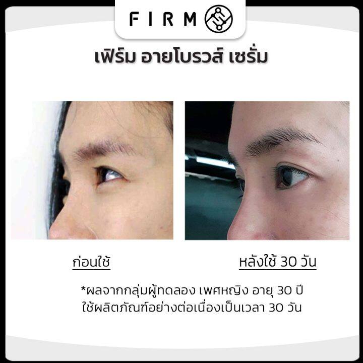 โปรด่วน-1-แถม-1-firm-เซรั่ม-ปลูกคิ้ว-2-มล-คิ้วเข้ม-ขนดก-ผมหนา-ตาสวย-คิ้วเข้มธรรมชาติ-ปลูกหนวด-ปลูกผม-จอน-firm-brows-amp-lashserum-hair