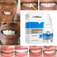 Tinh Chất Tẩy Trắng Răng Làm Sạch Răng Miệng Khử Mùi Hôi Miệng Oral Teeth Whitening Essence LANBENA 15ml thumbnail